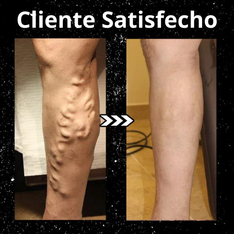 Calcetines Moldeadores Terapéuticos (OFERTA 2X1 GRATIS)